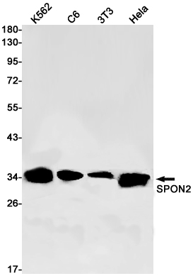 SPON2 Rabbit mAb